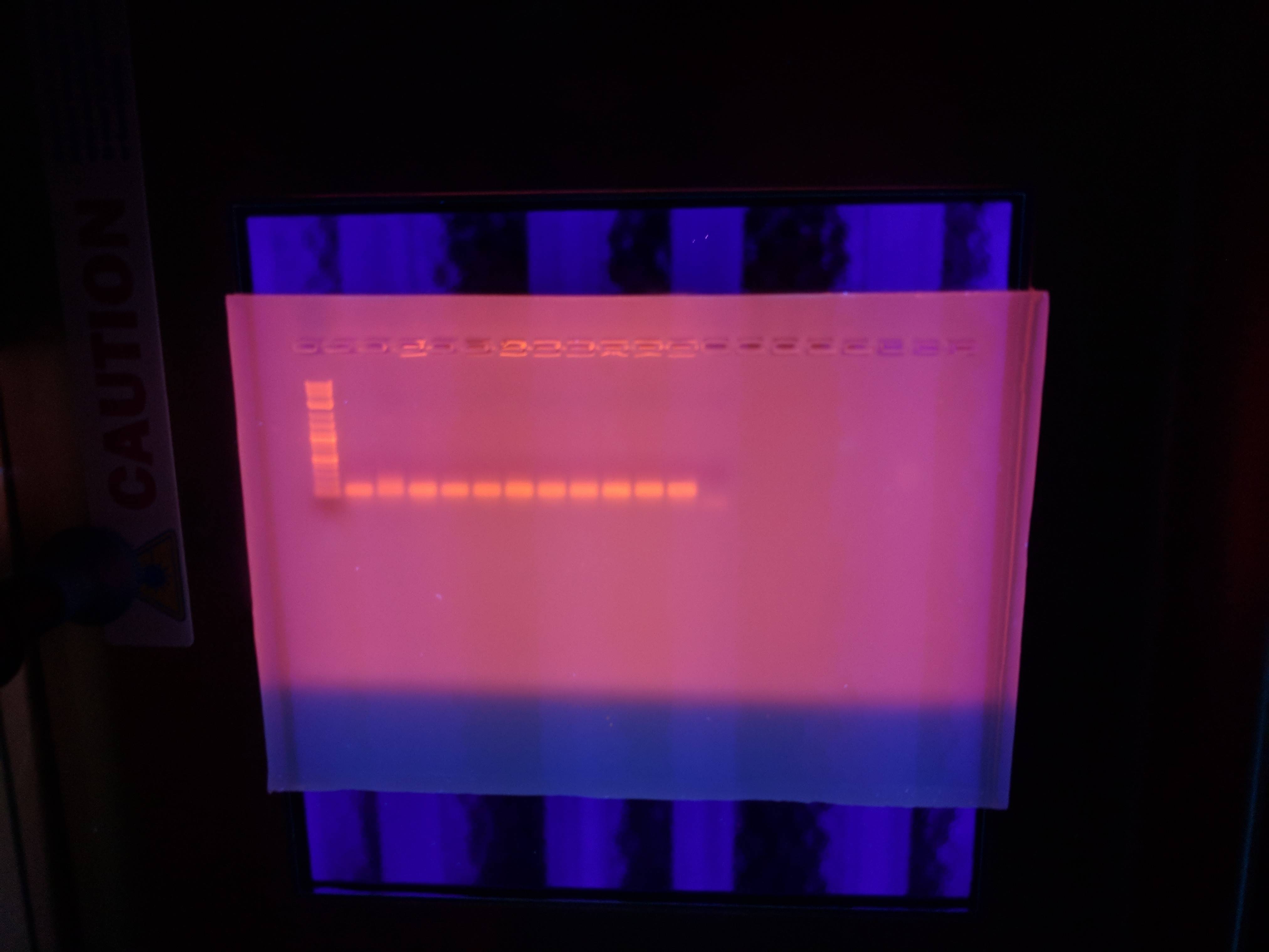 Gel electrophoresis BEFORE