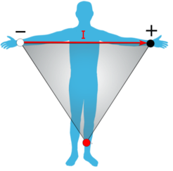 ECG Limb Lead Diagram