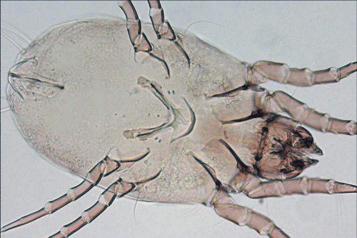 Dermatophagoides farinae (American house dust mite) from https://www.anallergo.it/