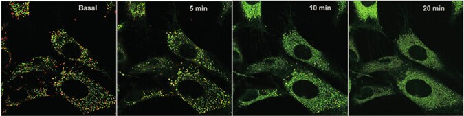 Mitochondrial membrane potential