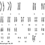 female karyotype