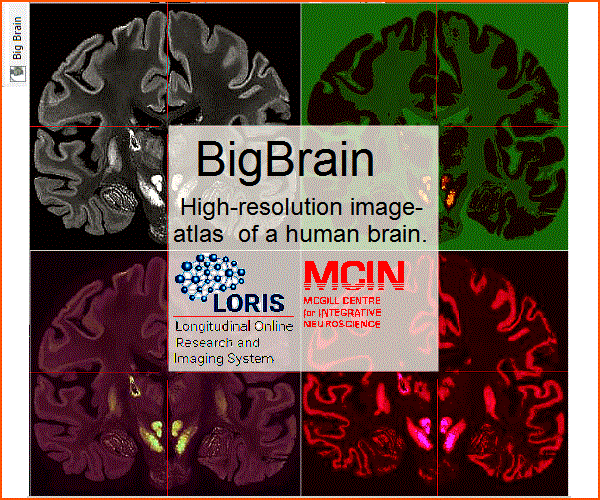 BigBrain