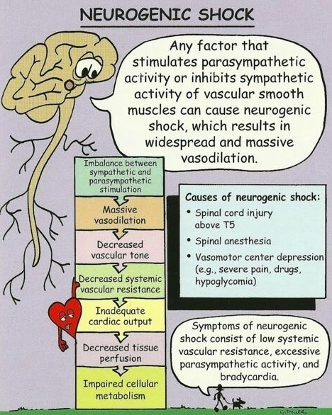 neuroshock