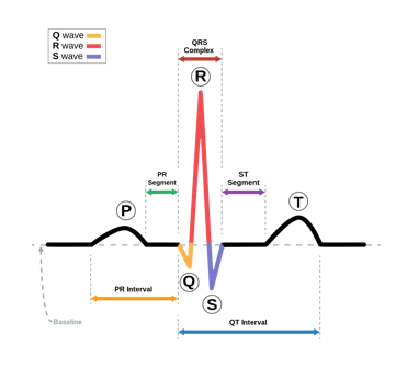 ECG 