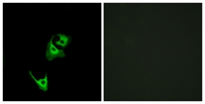 HeLa cells labeled with anti-GLP1R