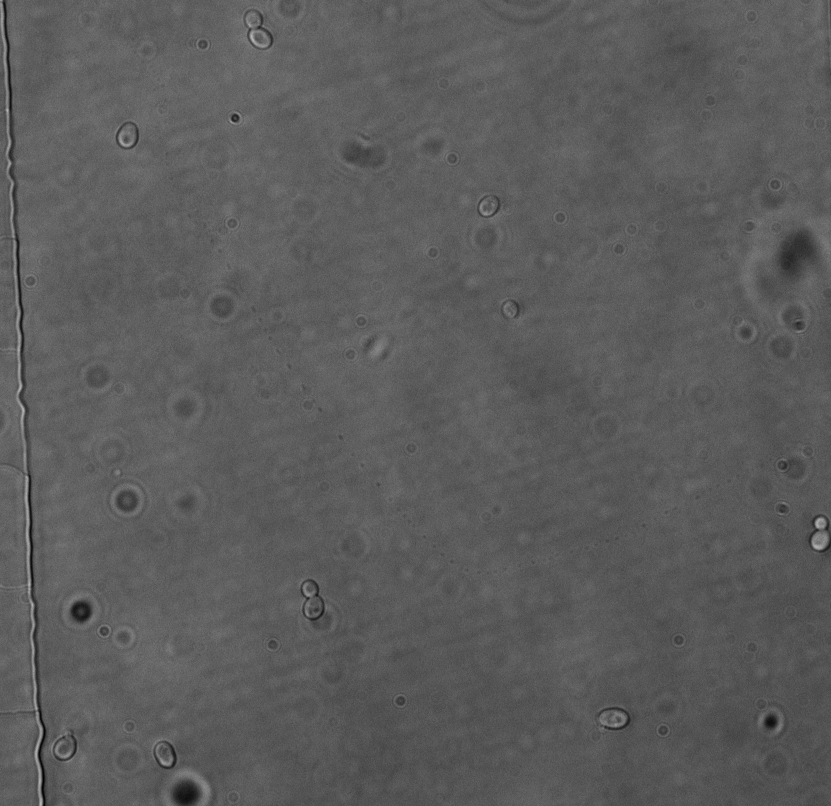 DIC image a yeast cells.