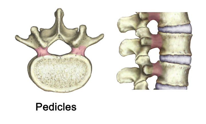 pedicle