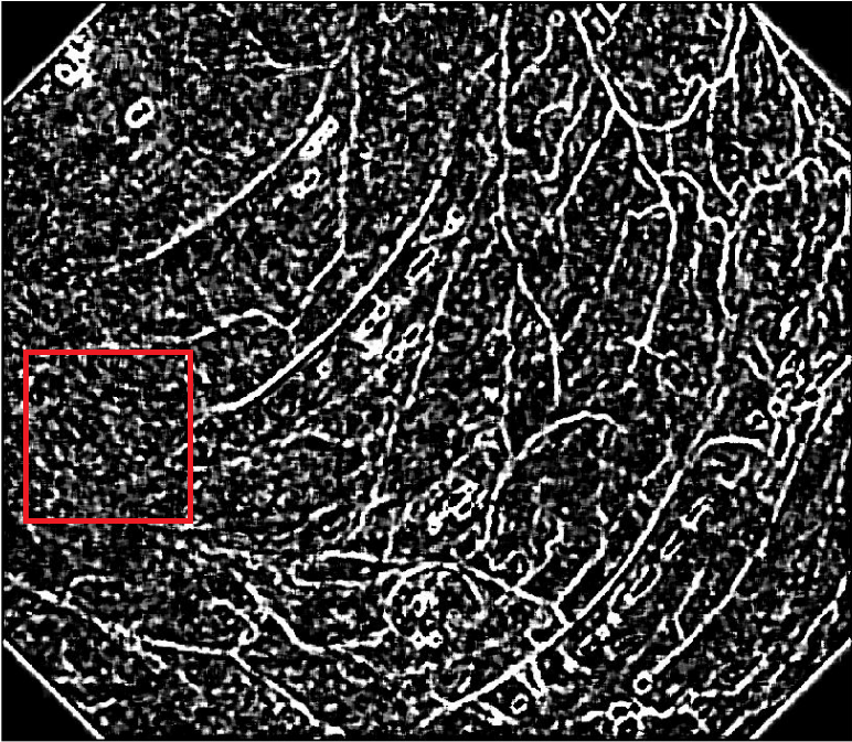 A segmented Medical Image