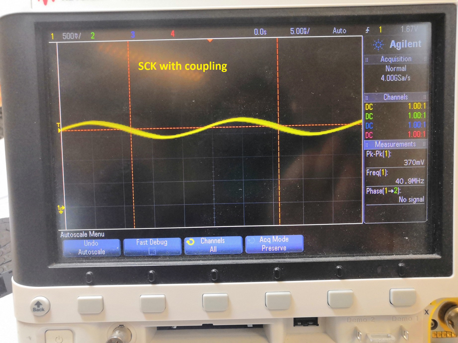 SCK with coupling