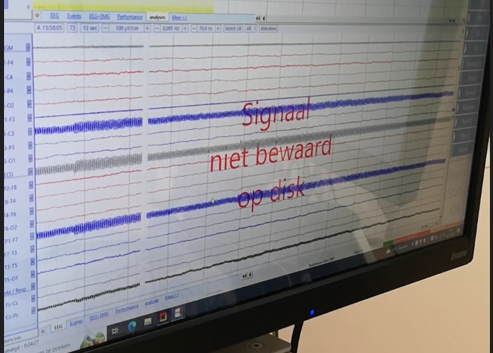 picture increased 50Hz artifact when smart plug was switched off