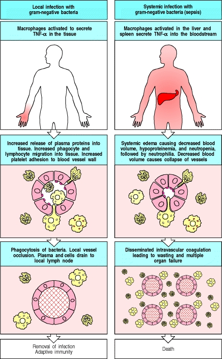 The release of TNF-α by macrophages induces local protective effects, but TNF-<span class=