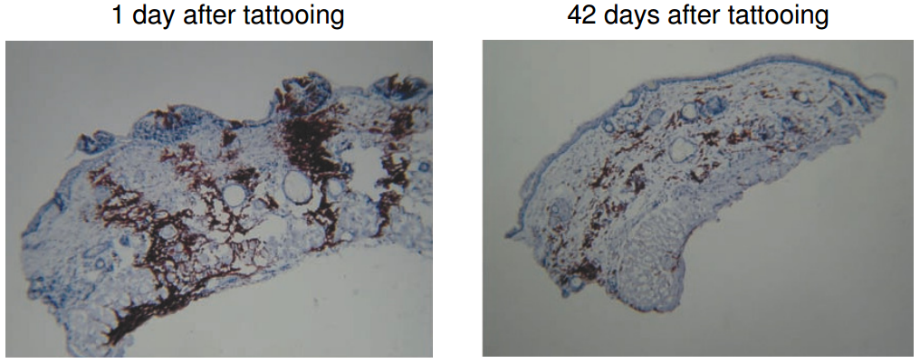 Mouse tattoo biopsy