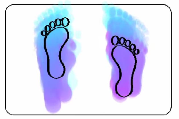 Color coded representation of pressure points under feet over time