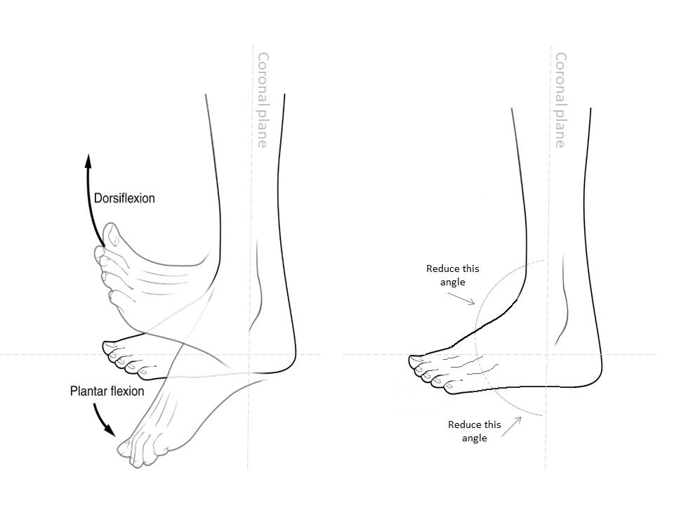 Dorsiflexion and plantarflexion angle decreasing