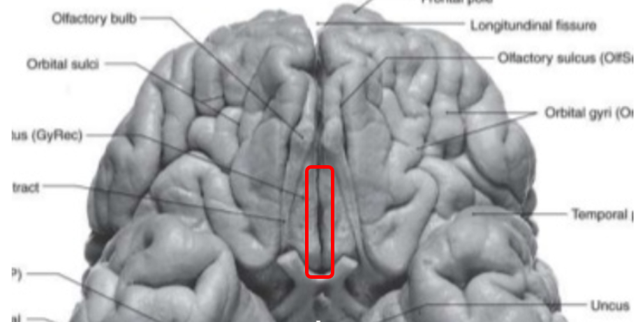 Ventral View of Brain