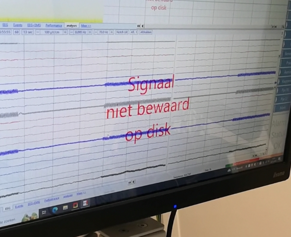 recording of normal 50Hz artifact switched on and off