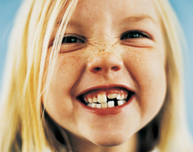 young grinning child showing off her gapped tooth