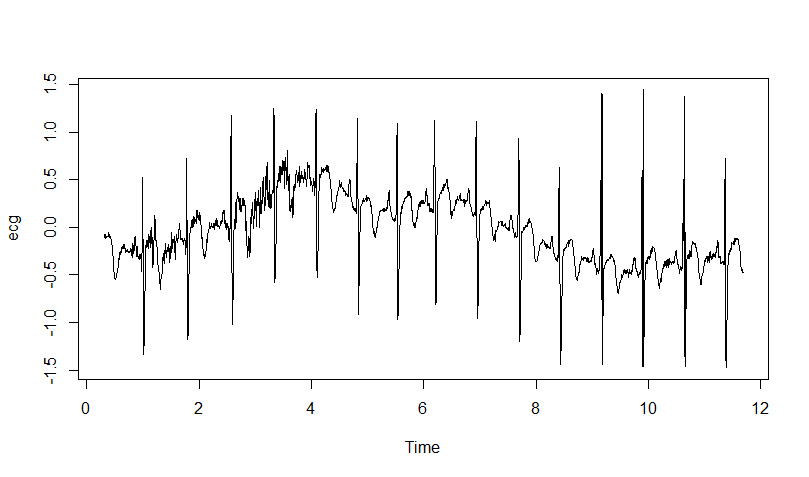 ECG data from R package ade4