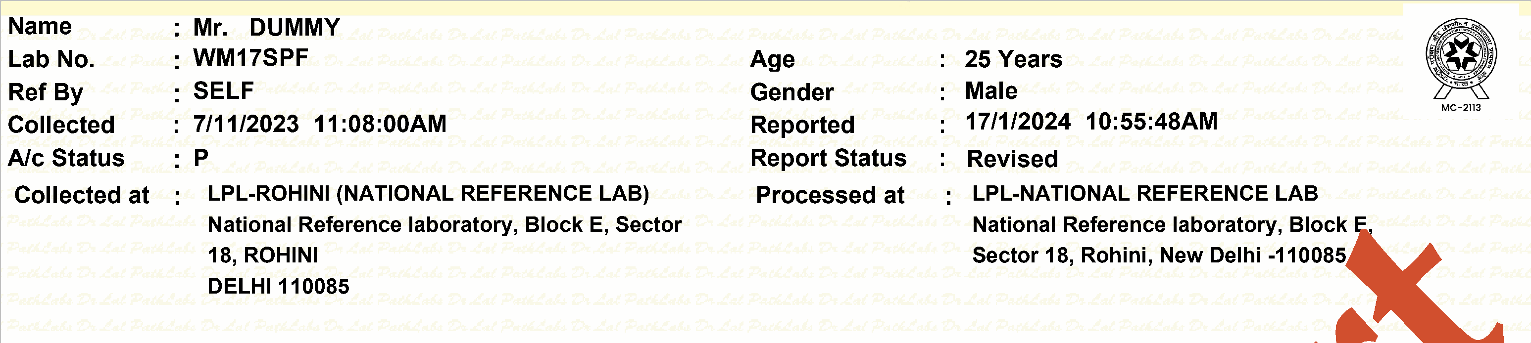 extracted single-cell table