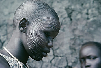 Scarification