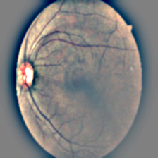 retinal image