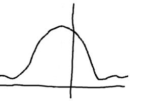 left diffraction pattern