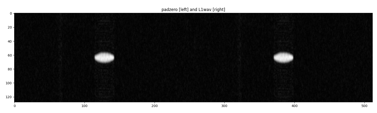 zero-padding v.s. L1Wav