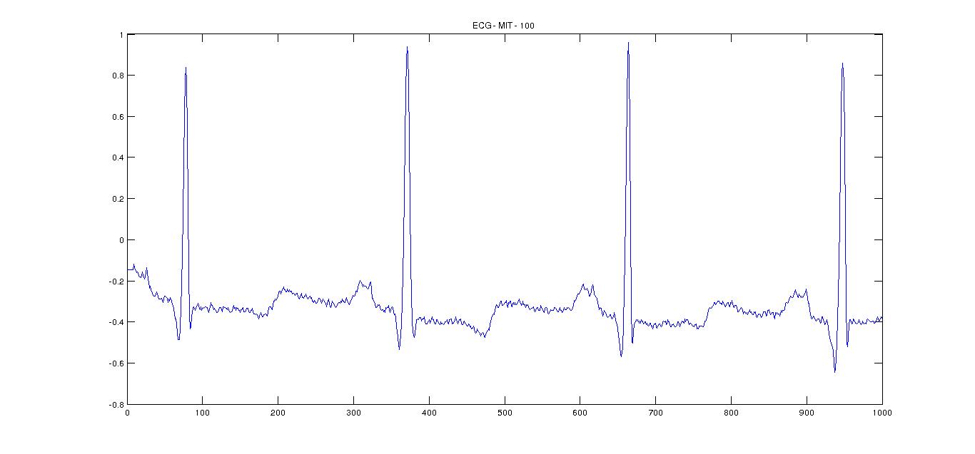 Original signal - MIT - 100