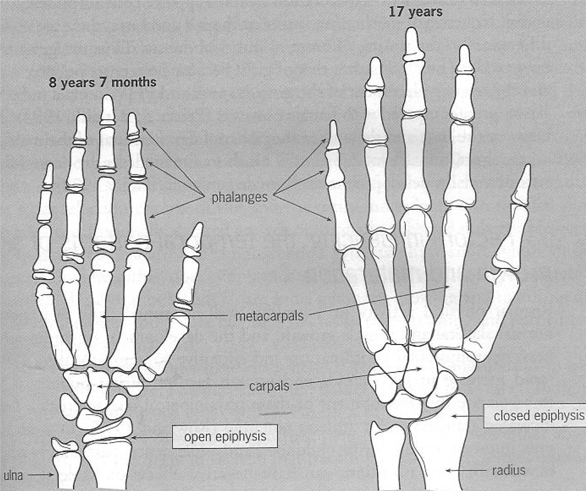 Growth Plates in the human hand