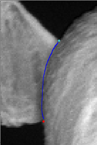 Example image. Given are the start and endpoint of the spline.