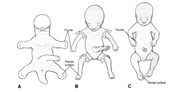 Fig1