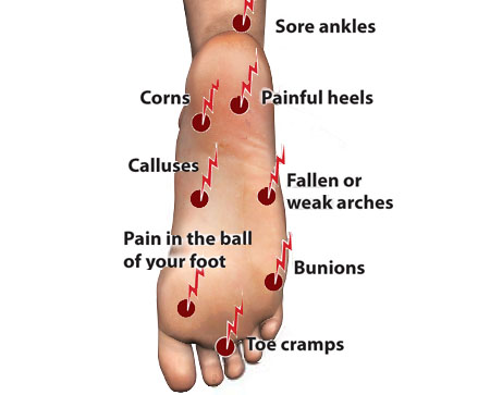 Bottom of Foot Diagram