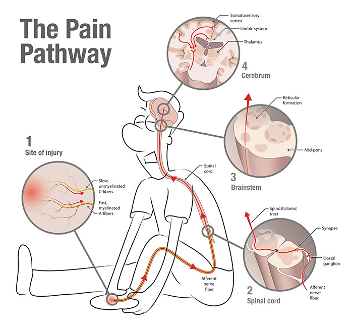 painpathway