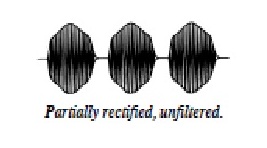 The waveform looks like as shown. It has hf sinusoidal oscillation in active part