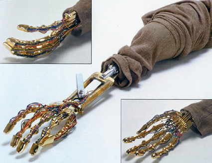 Anakin robotic arm