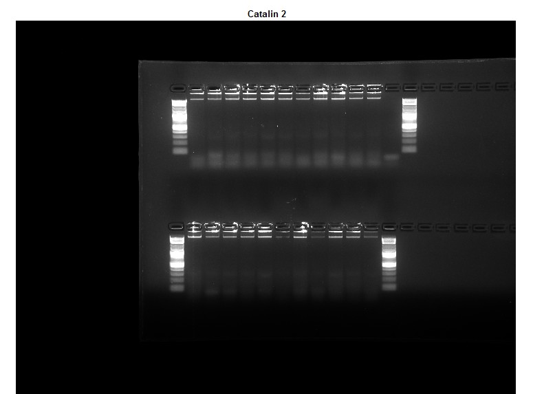 Gel electrophoresis AFTER