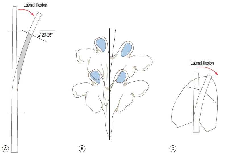 Lateral Flexion