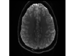 Antomic image of 2D axial slice