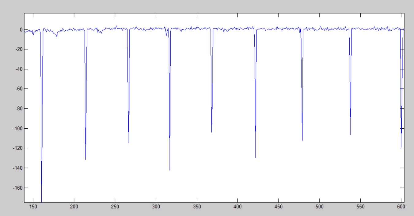 part of ECG signal